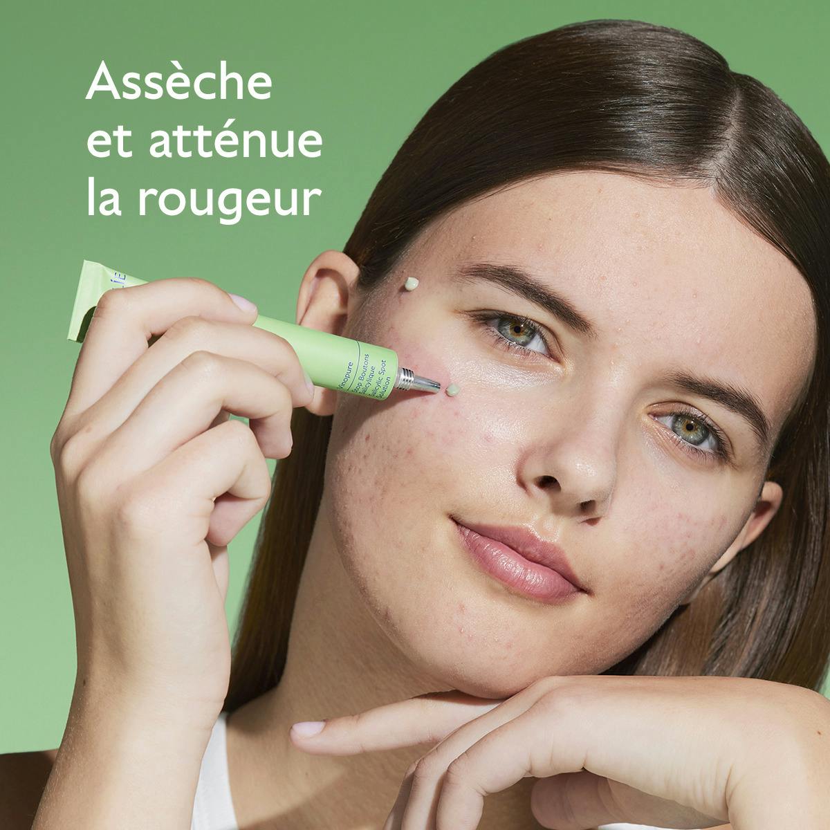 Stop Boutons Salicylique l'Acide Salicylique
