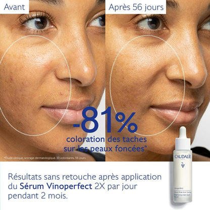 Sérum Éclat Anti-Taches à la Viniférine, alternative à la Vitamine C - Grand Format