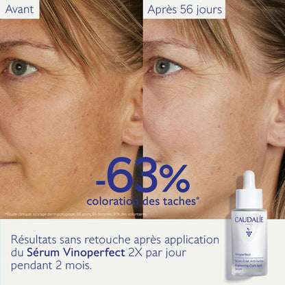 Sérum Éclat Anti-Taches à la Viniférine, alternative à la Vitamine C - 30ml